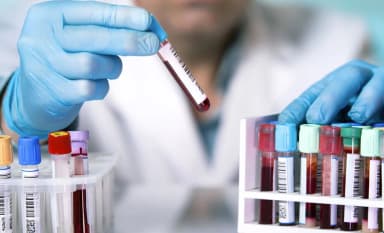 Мигранты из Кыргызстана в России заново сдают анализы на инфекционные болезни